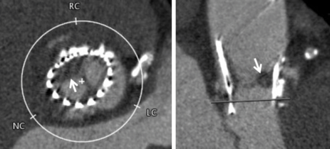 Captura_de_Tela_2017-09-01_às_19.01.56_edited