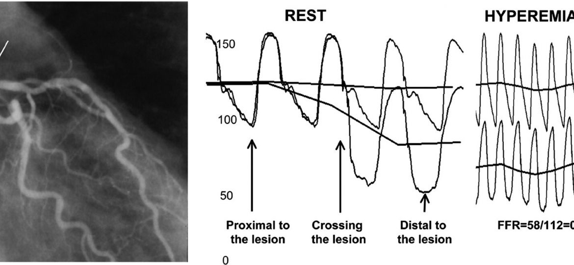 comparate trial